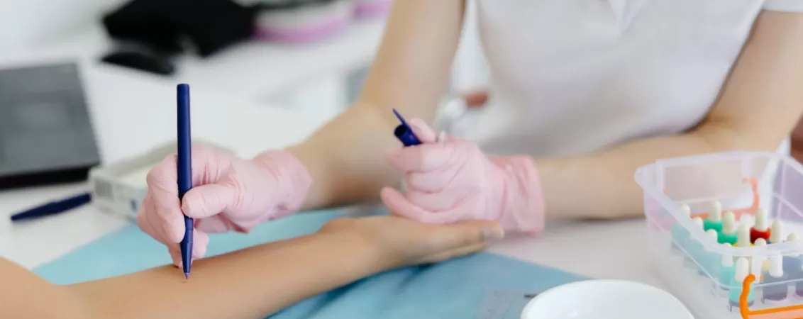 Doctor efectuand un test de alergie cutanata pe pielea unui pacient cu pielea alba