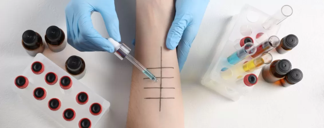 Doctor efectuand un test de alergie cutanata pe pielea unui pacient cu pielea deschisa la culoare