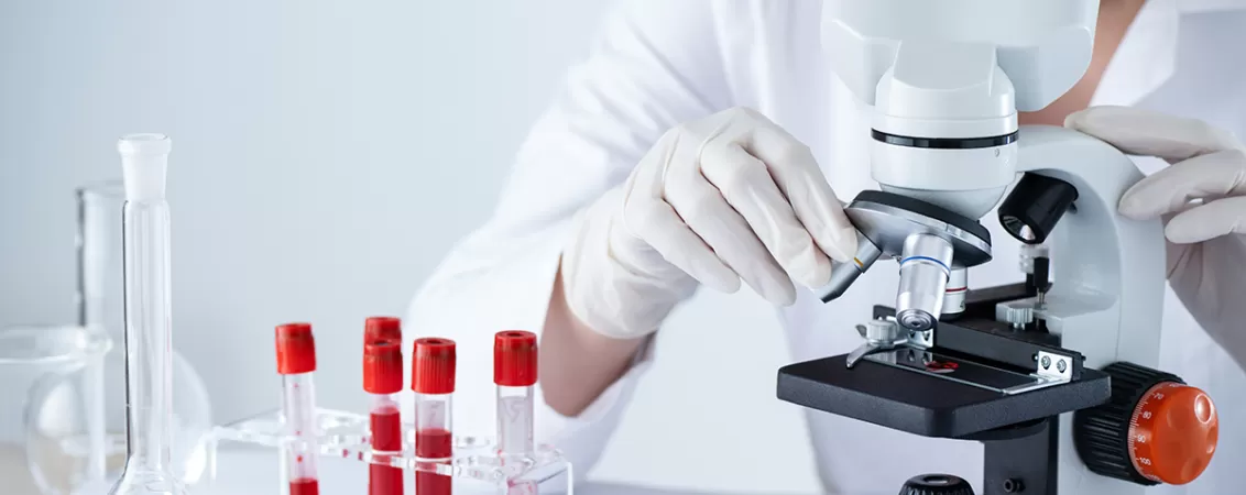 Femeie care priveste prin microscop o lamela cu probe de sange rosu in laborator