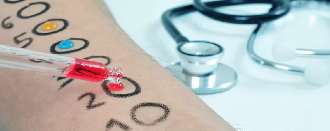 Prim-plan cu brat unui tanar care efectueaza un test de alergie in calbinetul medical