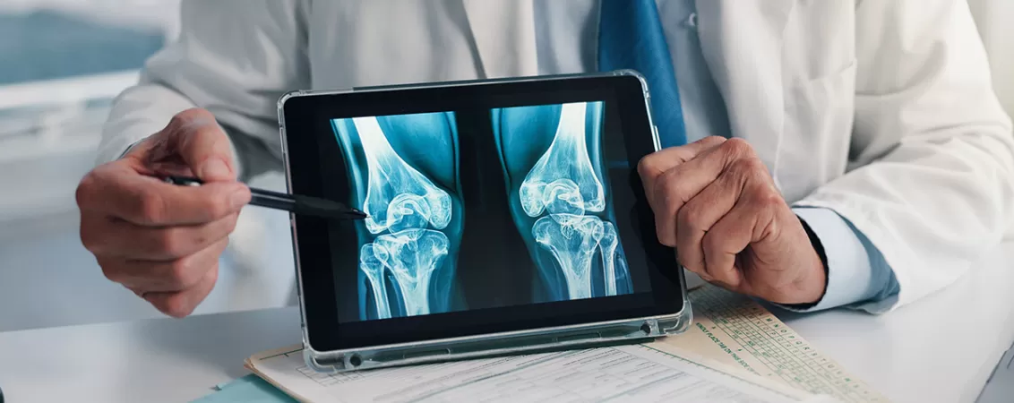 Maini care tin o tableta cu radiografie a genunchiului, concept de diagnostic medical digital