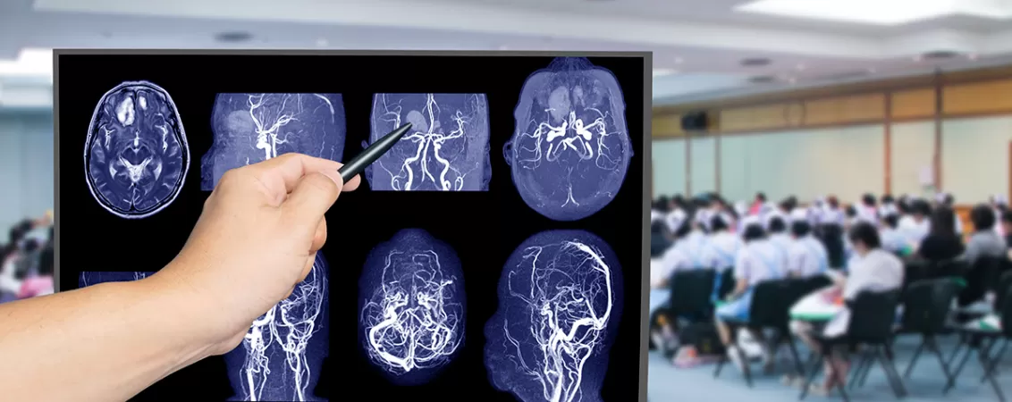 Medic indicand o anomalie a unui vas de sange pe un set de imagini Angio RMN