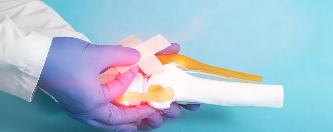 Medic traumatolog ortoped care aplica un plasture pe un model anatomic al genunchiului uman