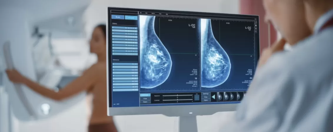 Imagini mamografie afisate pe monitor, cu pacienta in fundal
