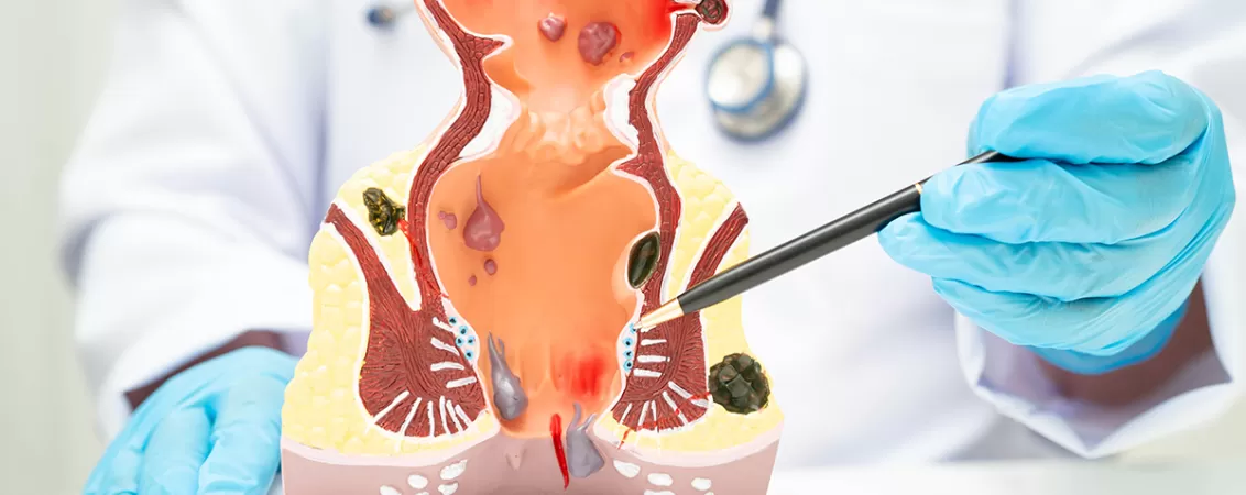 Medic ce indica rectul pe un model anatomic.