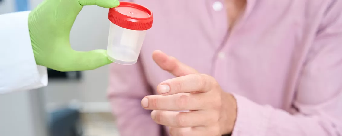 Cadru medical care ofera unui barbat un recipient pentru colectarea probelor, in context de investigatii si teste medicale