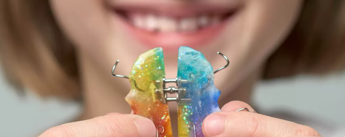 Copil zambitor care prezinta un disjunctor maxilar colorat, evidentiind tratamentul ortodontic si corectarea alinierii dintilor intr-un mod prietenos si pozitiv.