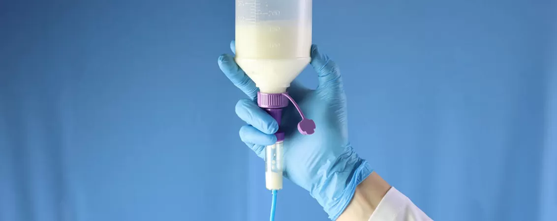 Flacon cu solutie pentru nutritie enterala suspendat si conectat la sistem de perfuzie, ilustrand administrarea controlata a dietei lichide in cadrul tratamentului medical.