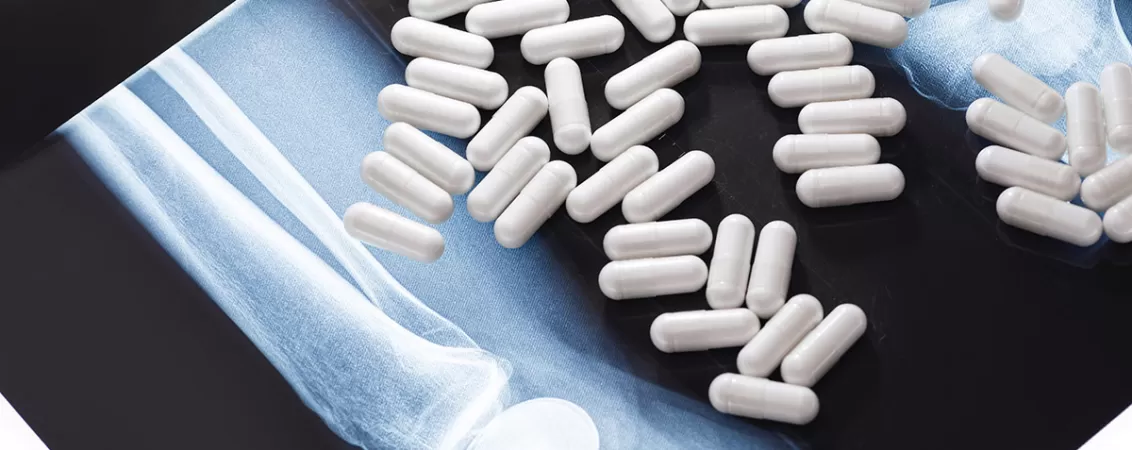 Imagine de aproape cu capsule albe de supliment alimentar, prezentate pe un fundal intunecat, evidentiind textura si forma acestora pentru promovarea sanatatii si nutritiei.