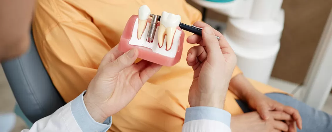 Prim plan cu un medic dentist tinand in mana un model de dantura, explicand structura dintilor si optiunile de tratament in cadrul unei consultatii stomatologice.