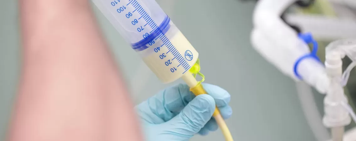 Proces de hranire a unui pacient in stare critica prin sonda de alimentatie, realizat in spital, ilustrand nutritia enterala si ingrijirea medicala specializata.