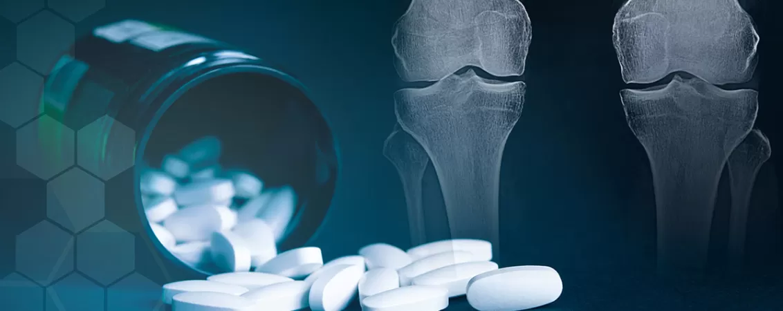 Suplimente cu glucozamina, condroitina si MSM pentru articulatii si ligamente, sugerand sustinerea sanatatii oaselor si mobilitatii