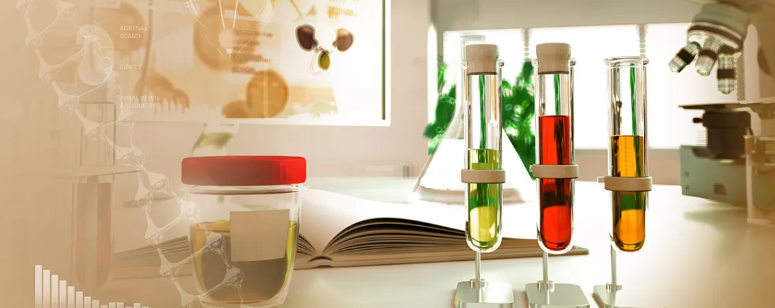 Diverse probe de urina si de sange intr-un laborator, reprezentand analizarea probelor pentru stabilirea unui diagnostic