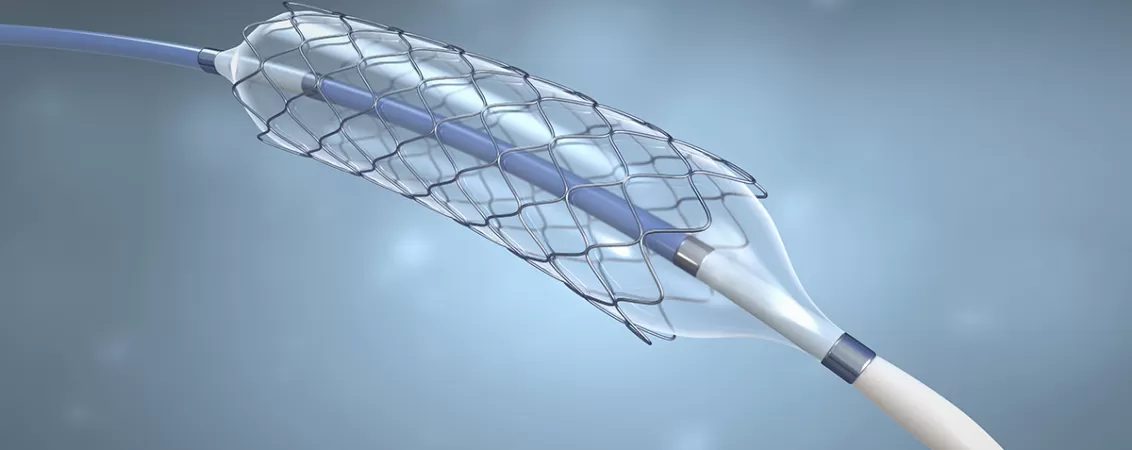 Ilustratie 3D montare stent