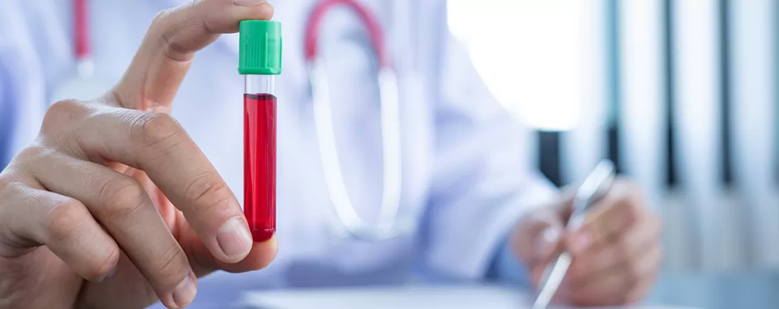 Medic purtand halat alb, tinand in mana o proba de sange necesara pentru analiza, ilustrand activitatea profesionala in domeniul sanatatii.