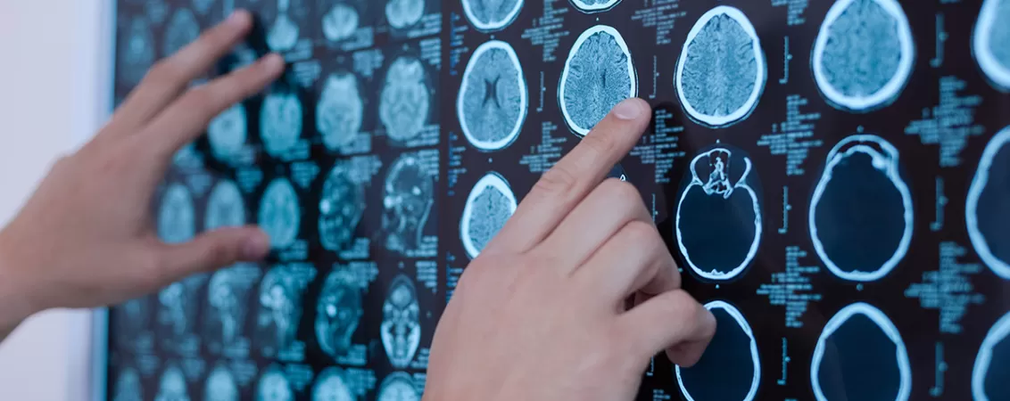 Radiografii ale creierului uman