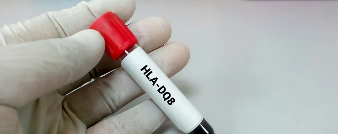 Test genetic pentru boala celiaca