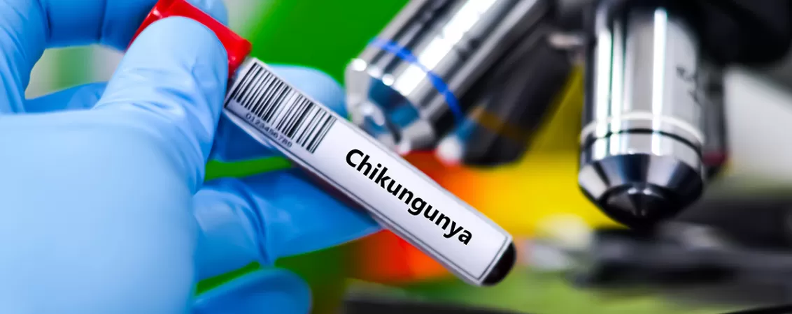 Test pozitiv infectia cu virusul Chikungunya