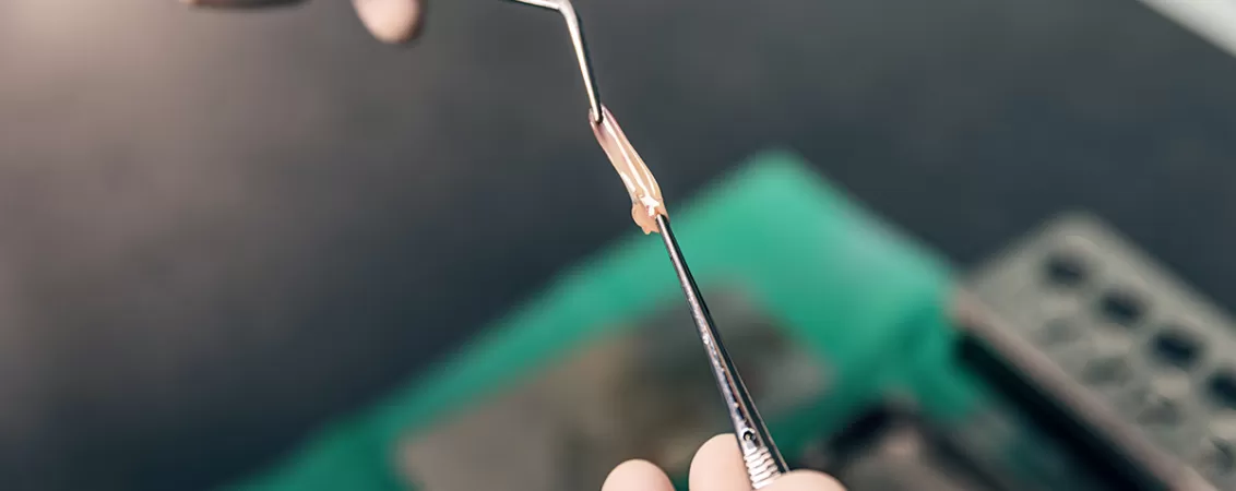 Trombocite care interactioneaza cu reteaua de fibrina formand conglomerate PRF, ilustrand procesul de coagulare si regenerare tisulara utilizat in medicina.