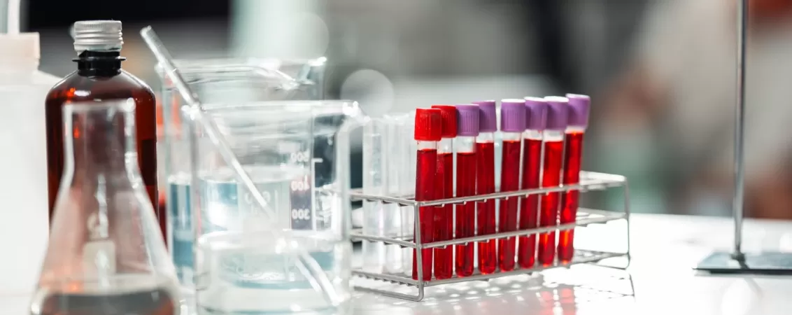 Cercetator efectueaza test de sange intr un laborator steril folosind echipament medical profesional