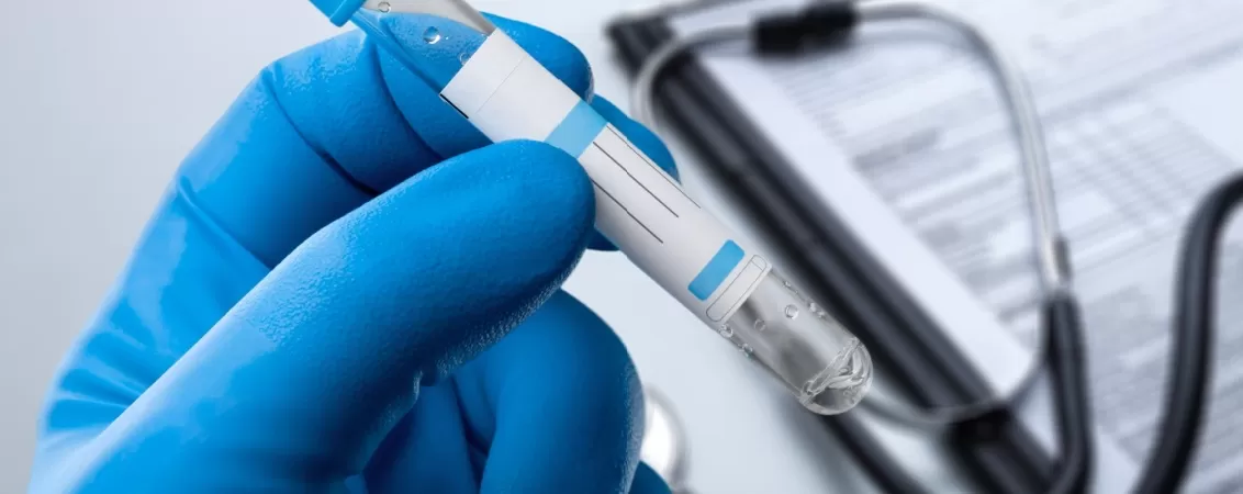 Eprubeta cu proba de testat si formular de analiza medicala, ilustrand procesul de laborator pentru testare si diagnostic clinic al pacientilor.