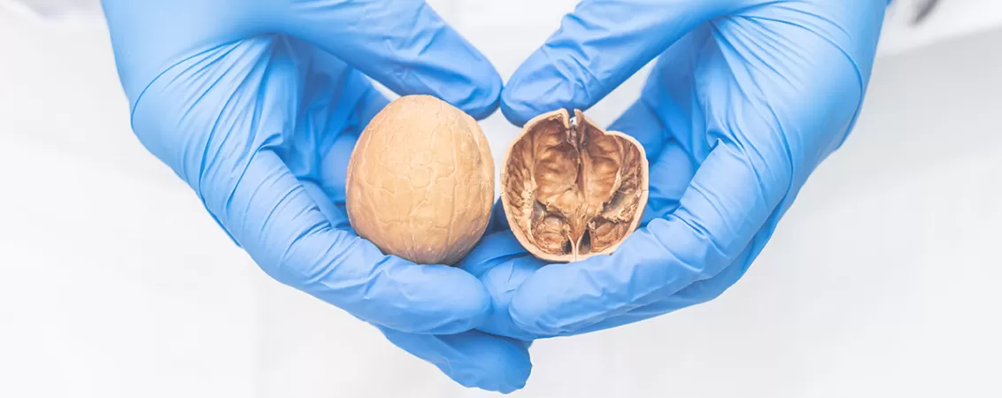 Imagine cu doua nuci, concept pentru cancerul testicular