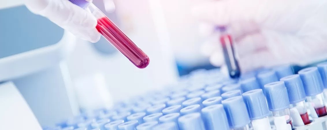 Lucrator de laborator pregateste probe de sange pentru analiza medicala in mediu clinic.