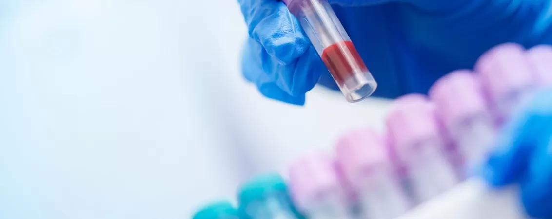 maini cu manusi tin proba de sange pentru analiza veterinara in laborator medical