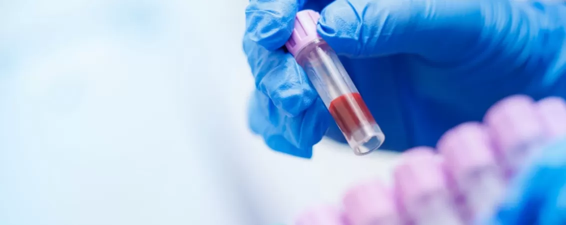 Maini cu manusi tinand o proba de sange pentru analiza veterinara, ilustrand recoltarea si testarea mostrelor biologice