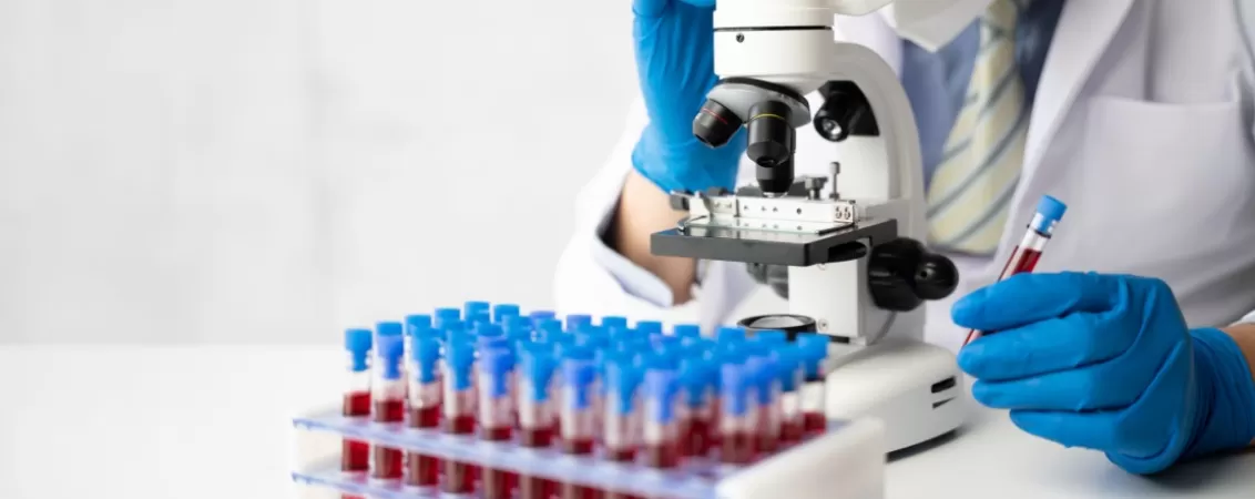 Mana unui medic preluand o eprubeta cu proba de sange pentru analize de laborator, evidentiind procedura medicala de diagnostic si investigatie clinica