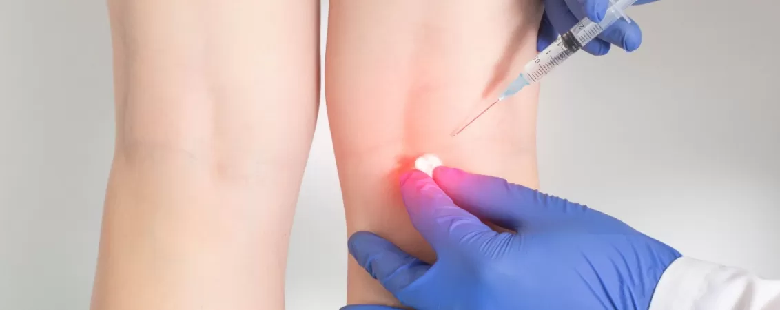 Medic administreaza injectie in articulatia umarului pacientului in cadrul unei proceduri medicale.