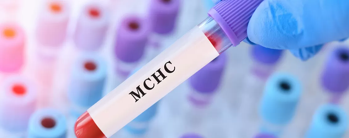 Medic tinand in mana o eprubeta cu proba de sange etichetata pentru analiza MCHC, ilustrand investigatiile hematologice din laboratorul medical.