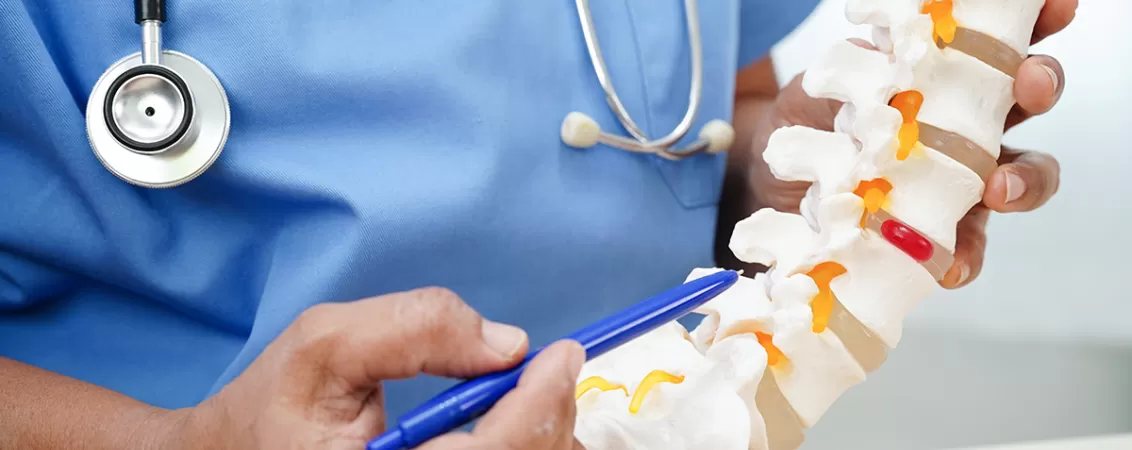 Model anatomic coloana cu hernie de disc.