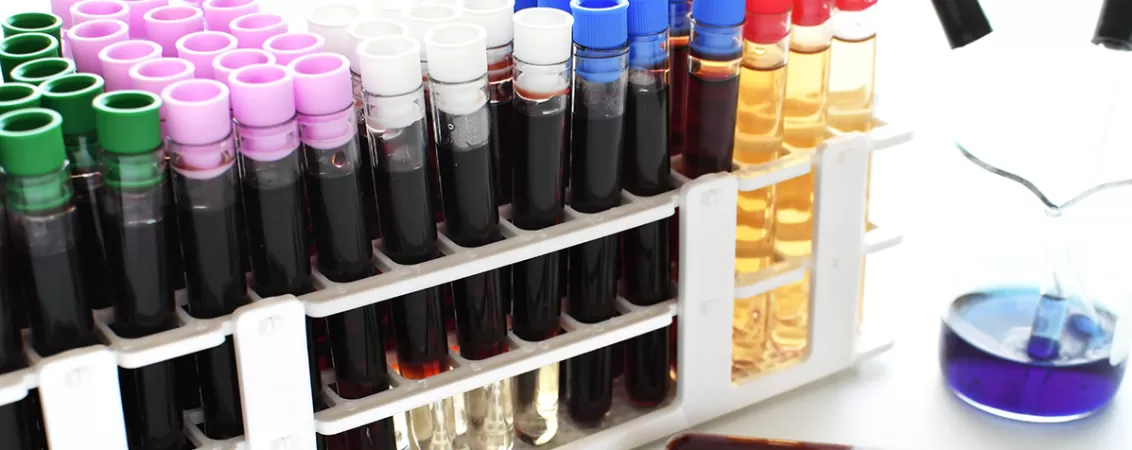 Probe de sange pentru testare genetica si alte analize pentru diabet