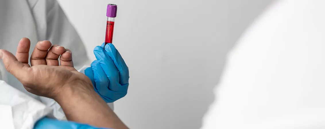 Recoltare de sange pt analize de uree si creatinina inainte de CT