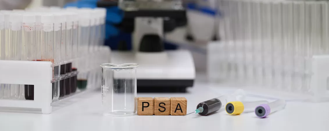 Tehnician de laborator calificat care efectueaza un test PSA, ilustrand analiza sangelui pentru depistarea si monitorizarea afectiunilor prostatei.