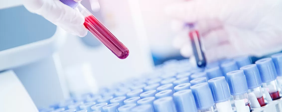 Tehnician de laborator pregateste probe de sange pentru teste medicale intr-un laborator clinic modern