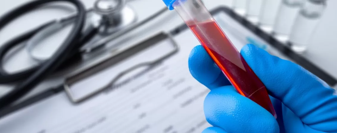 Tub cu proba de sange alaturi de formular de cerere pentru analiza de laborator medicala.