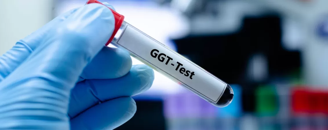 Tub de proba de sange pentru analiza GGT gama glutamil transferaza in laborator medical.