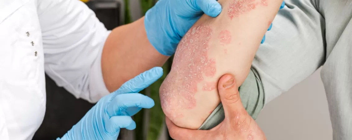 Medic dermatolog examinand pacient cu boala de piele