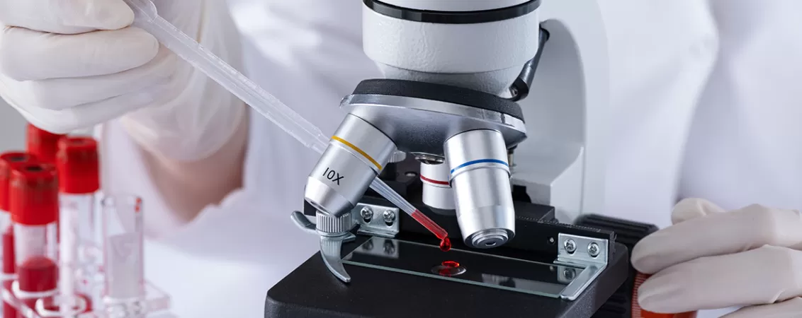 Reprezentant medical analizand o proba de sange la microscop in laborator.