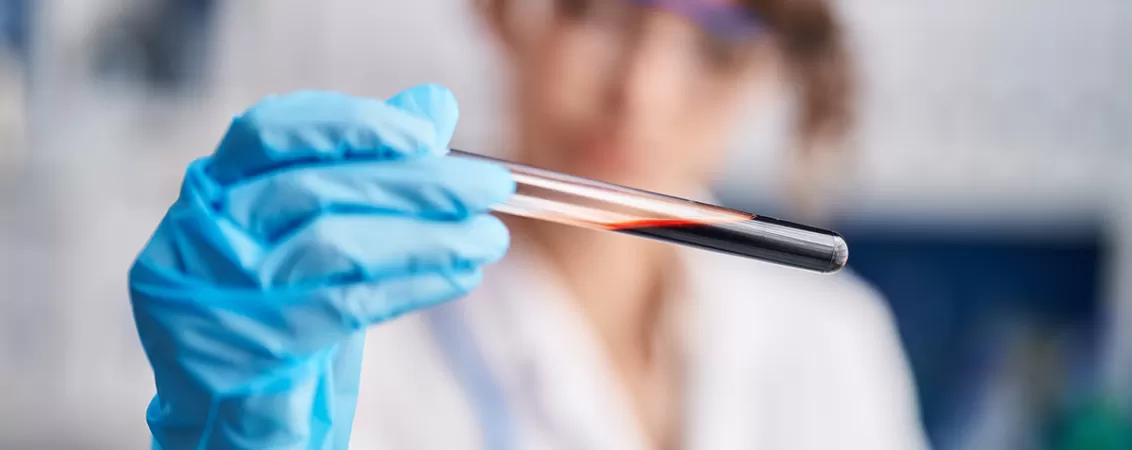 Tanara cercetatoare tinand o eprubeta cu proba de sange, analizand rezultatele in laborator.