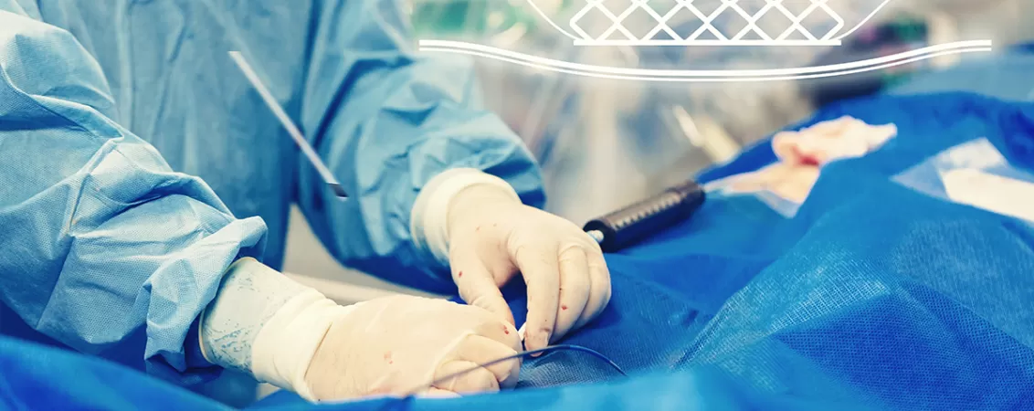 Cardiologie interventionala montare stent angioplastie coronariana