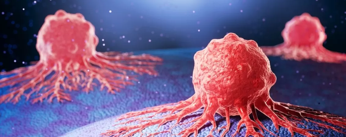 Ilustratie 3D a celulelor canceroase dezvoltate pe tesut uman