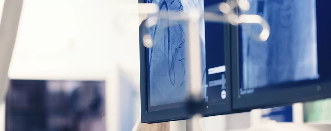 Interventie minim invaziva inchidere foramen ovale patent