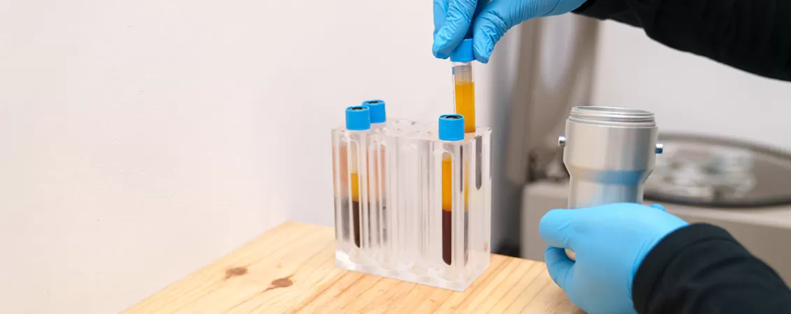Asistenta medicala introduce o proba de sange pentru analiza in laborator