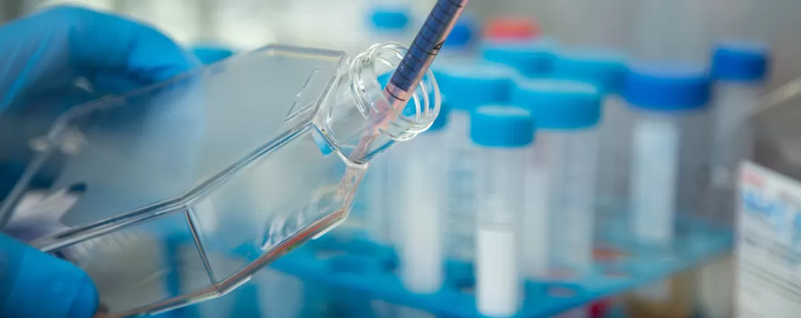 Cultura de celule in recipient medical
