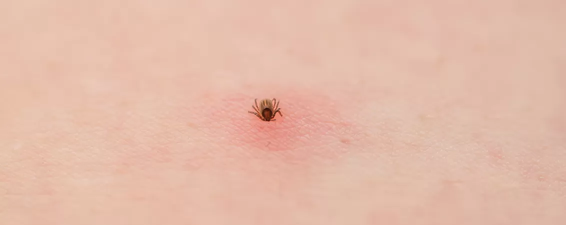 O capusa care a intrat in piele