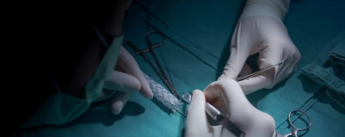 Chirurg vascular efectueaza o interventie minim invaziva asupra vaselor de sange