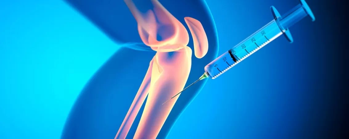 Ilustratie medicala care prezinta structura osoasa si efectele osteoporozei asupra osului